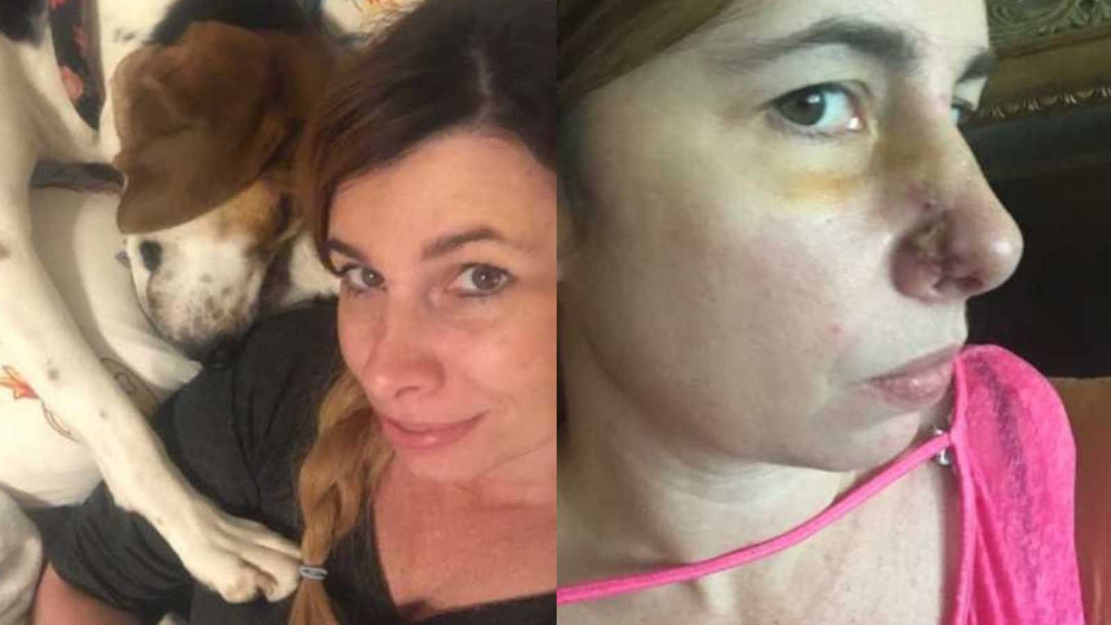 ‘My dog was so persistent.’ Rescue dog detects cancer on owner’s nose
