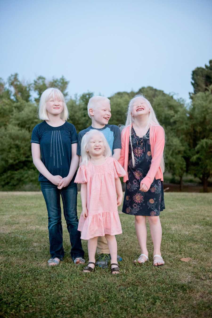 ‘Life with four children with albinism has been quite the adventure ...