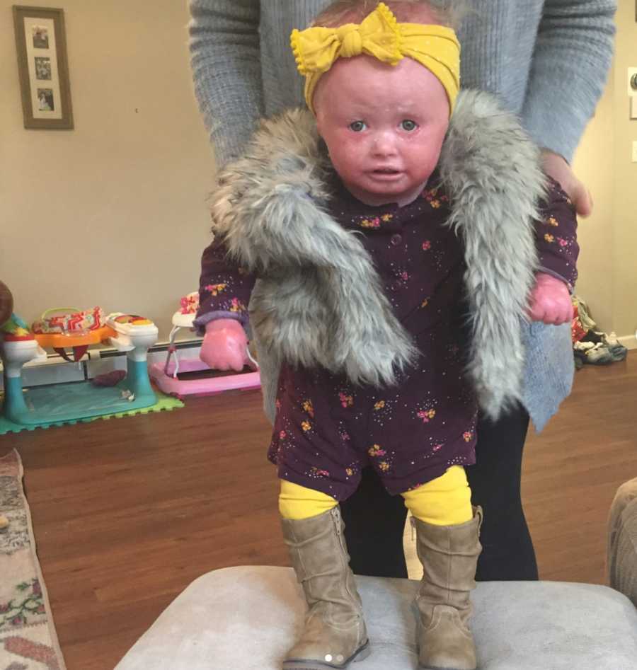 The Girl Born With Thick Skin Literally My Daughter s Journey With the-girl-born-with-thick-skin-literally-my-daughter-s-journey-with