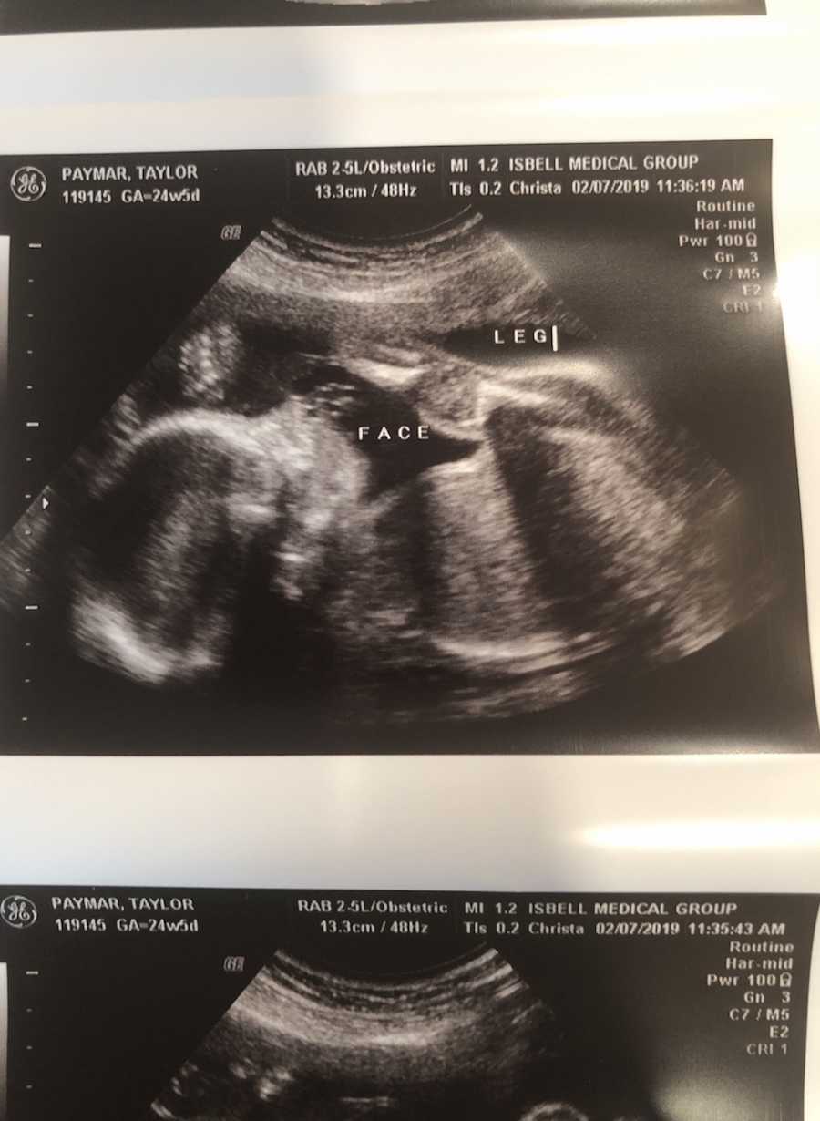 ‘She was in her bouncer when I heard, ‘CRACK!’ A voice in my head said, ‘Take her, NOW.’ There