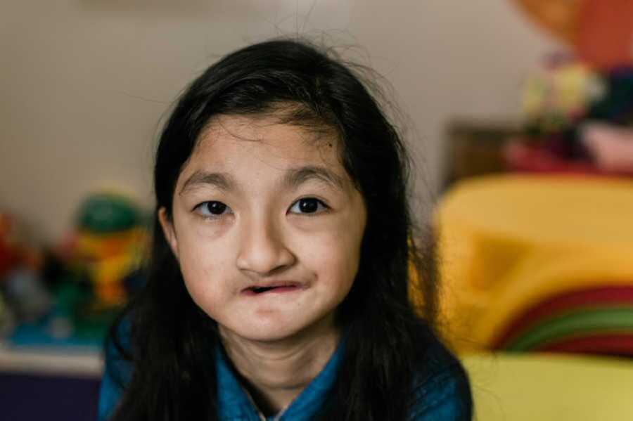 Girl with limb difference smiling at camera