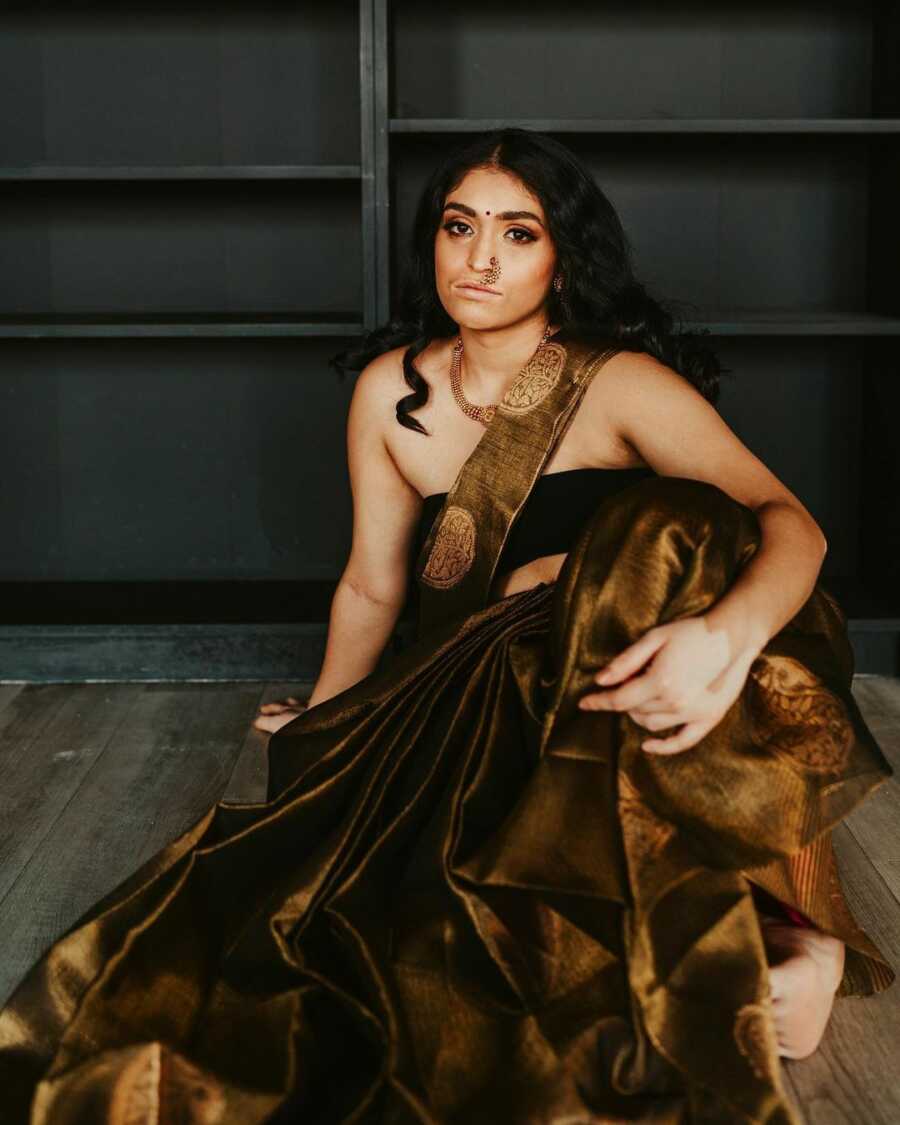 South Asian Women With Vitiligo Create Stunning Photoshoot Raising ...