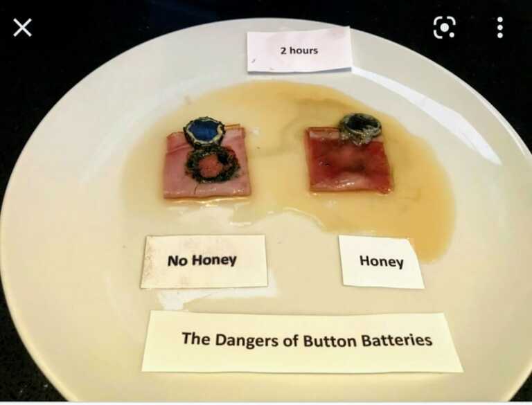 Mom Warns Of Button Battery Ingestion After Honey Packets Save Daughter